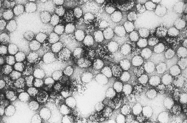 Yellow fever virus - link